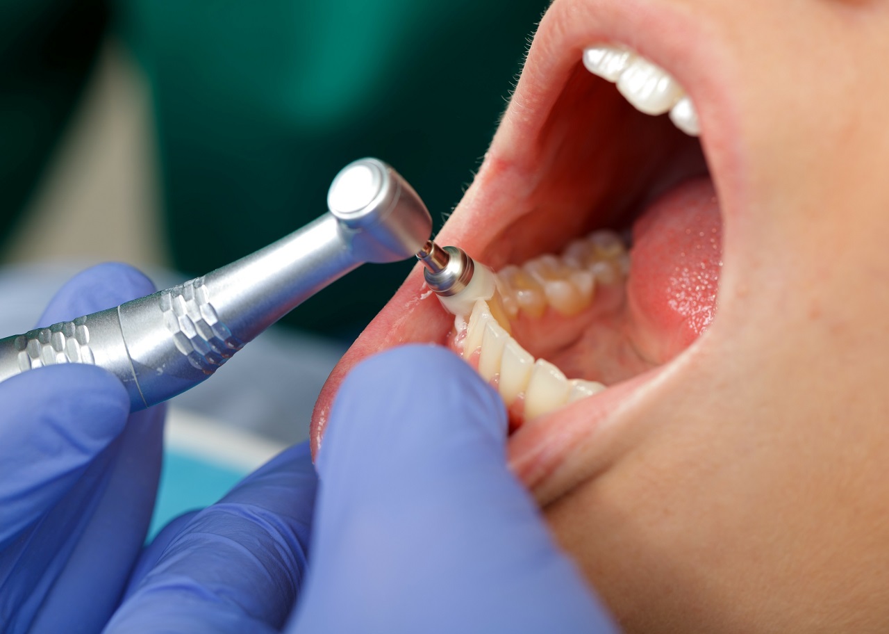 Stomatolog – w jaki sposób może utrzymać Twoje zęby w dobrym i zdrowym stanie?